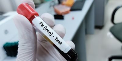 A gloved hand holds a test tube containing a sample of blood. there is a label on the test tube which says Fe (Iron) test